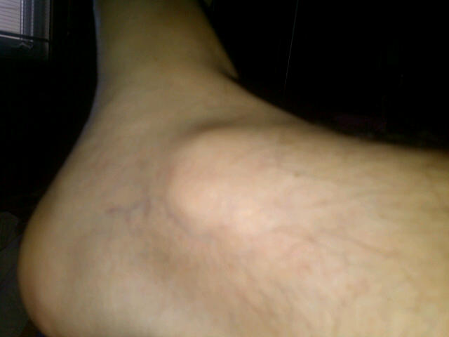 This is a normal ankle