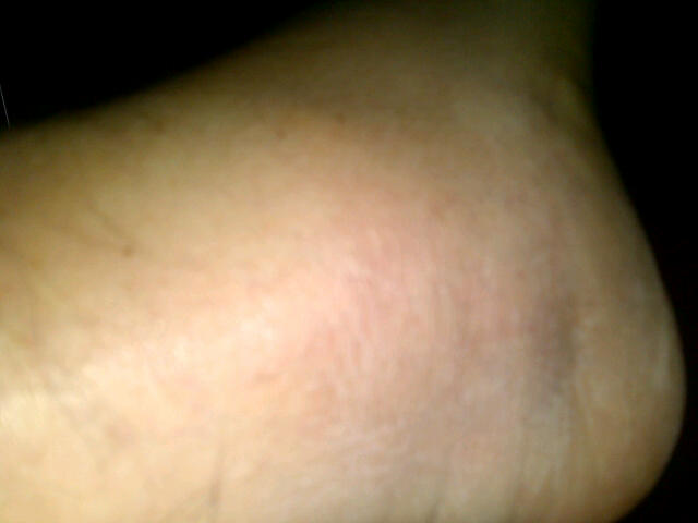 Can u spot my ankle? hmmm?